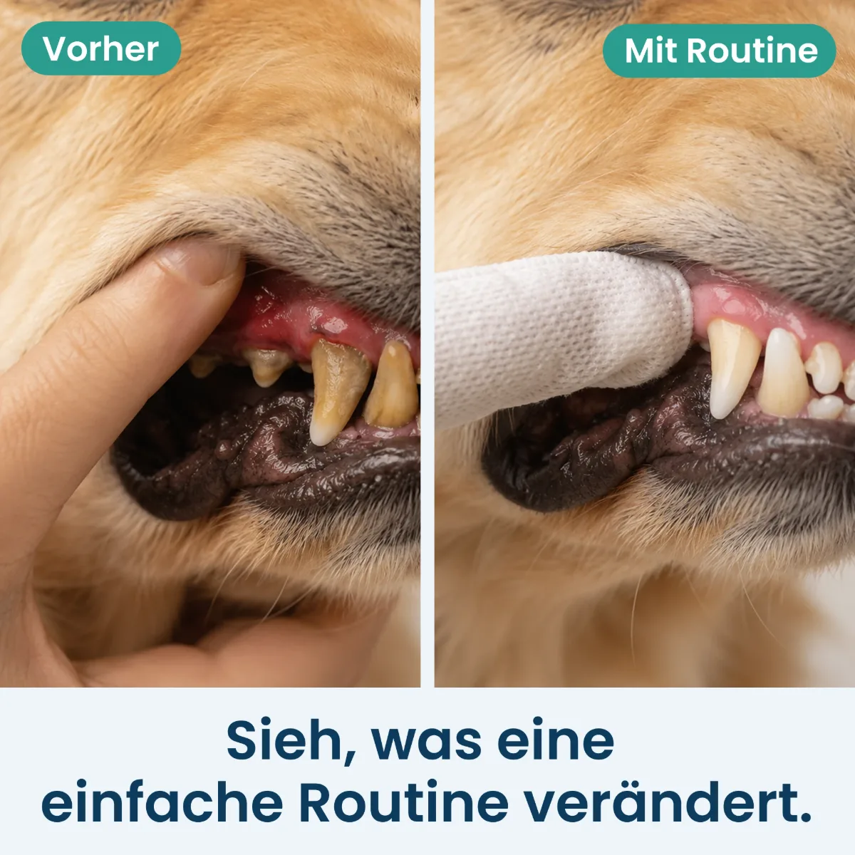 Vorher-Nachher-Vergleich: Zahnstein am Zahnfleischrand und Zähne mit Routine